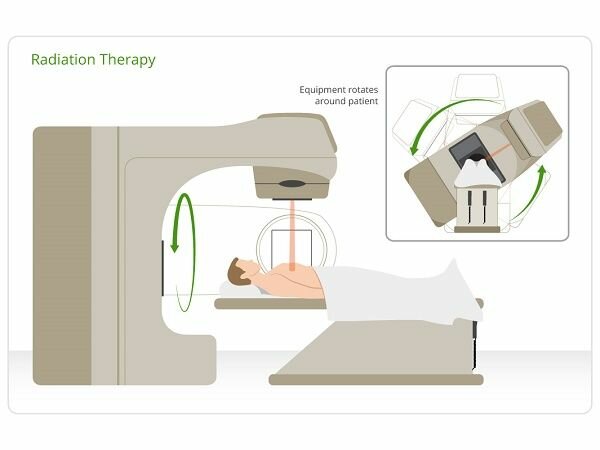 radiation_therapy_procedure